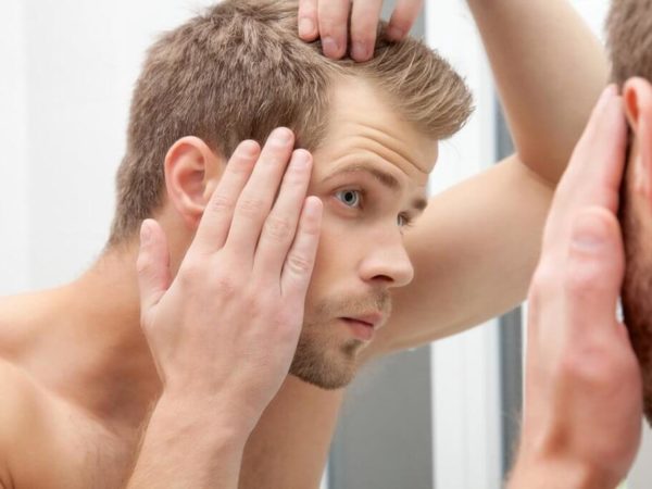 Best Hair Loss Shampoo And Dandruff Shampoo For Men 1024x683